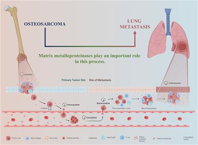 Global scientific trends on matrix metalloproteinase and osteosarcoma: A bibliometric and visualized analysis